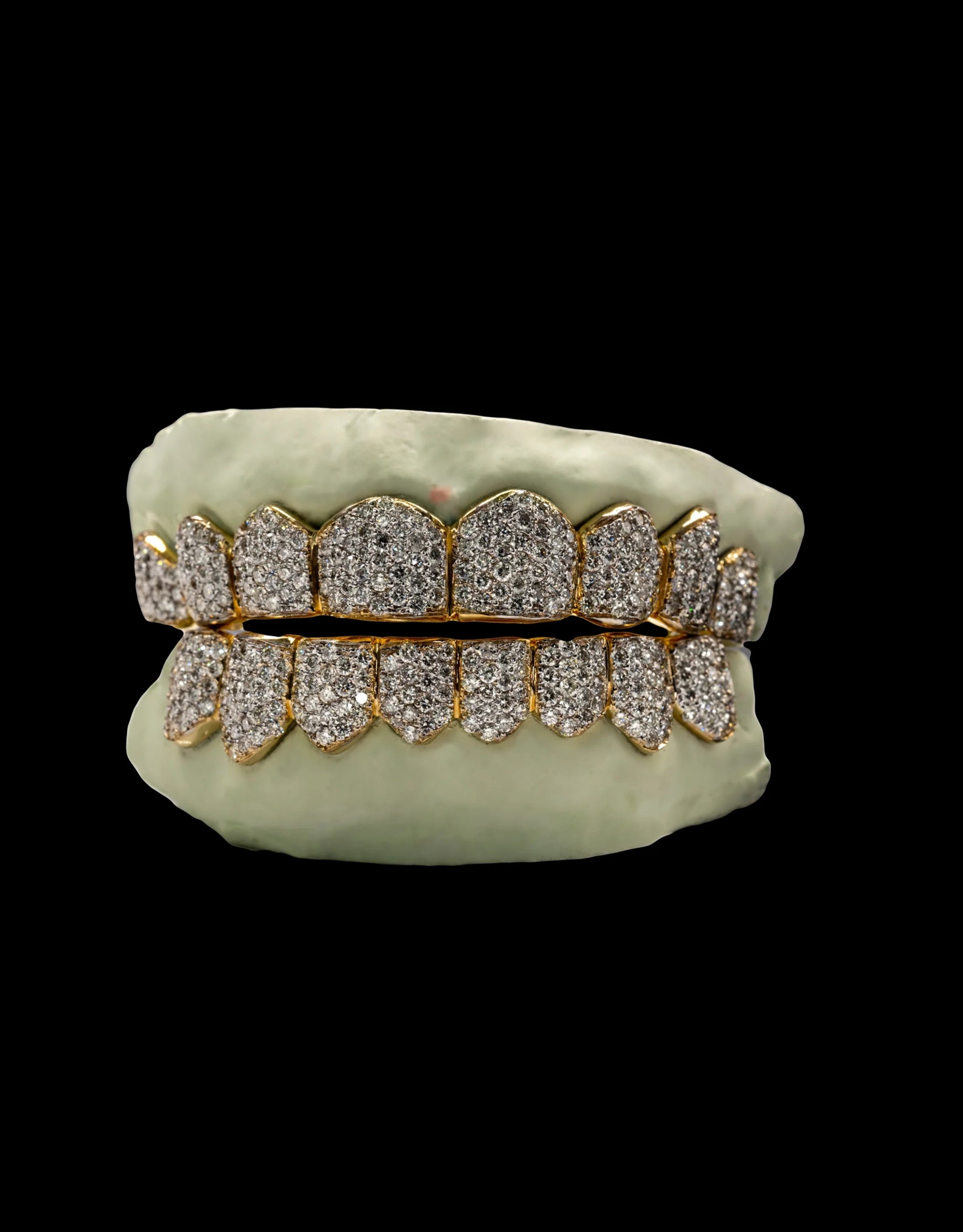 FULLY ICED CZ GRILL ZIG ZAG SETTING