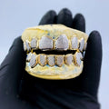 Diamond dust grillz