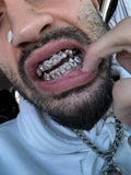 Starburst cut grillz diamond dust grillz