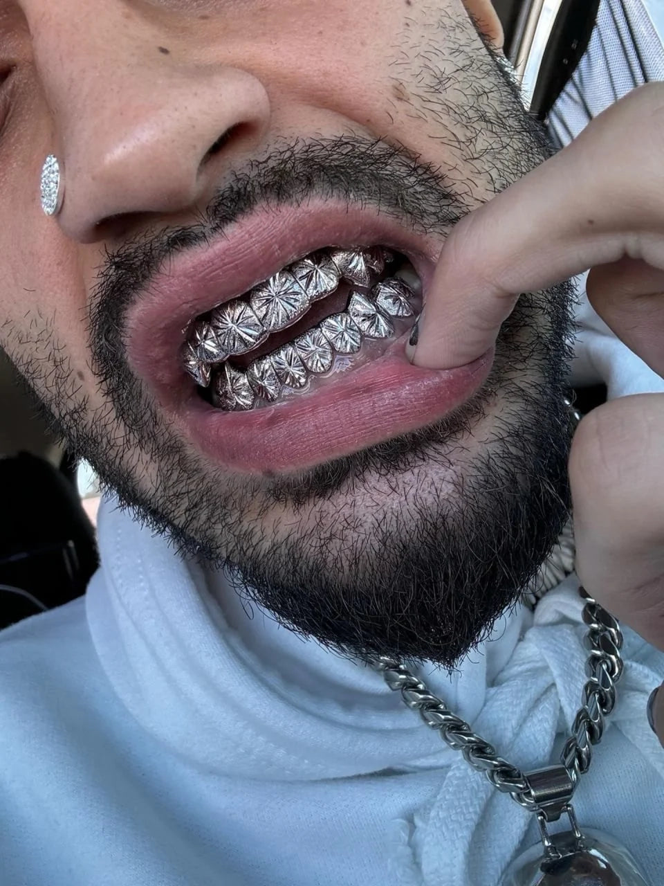 Starburst cut grillz diamond dust grillz
